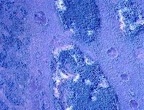 peat plateau melting